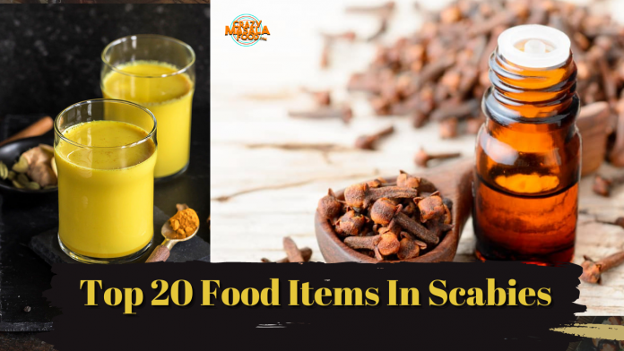 top 20 food items in scabies