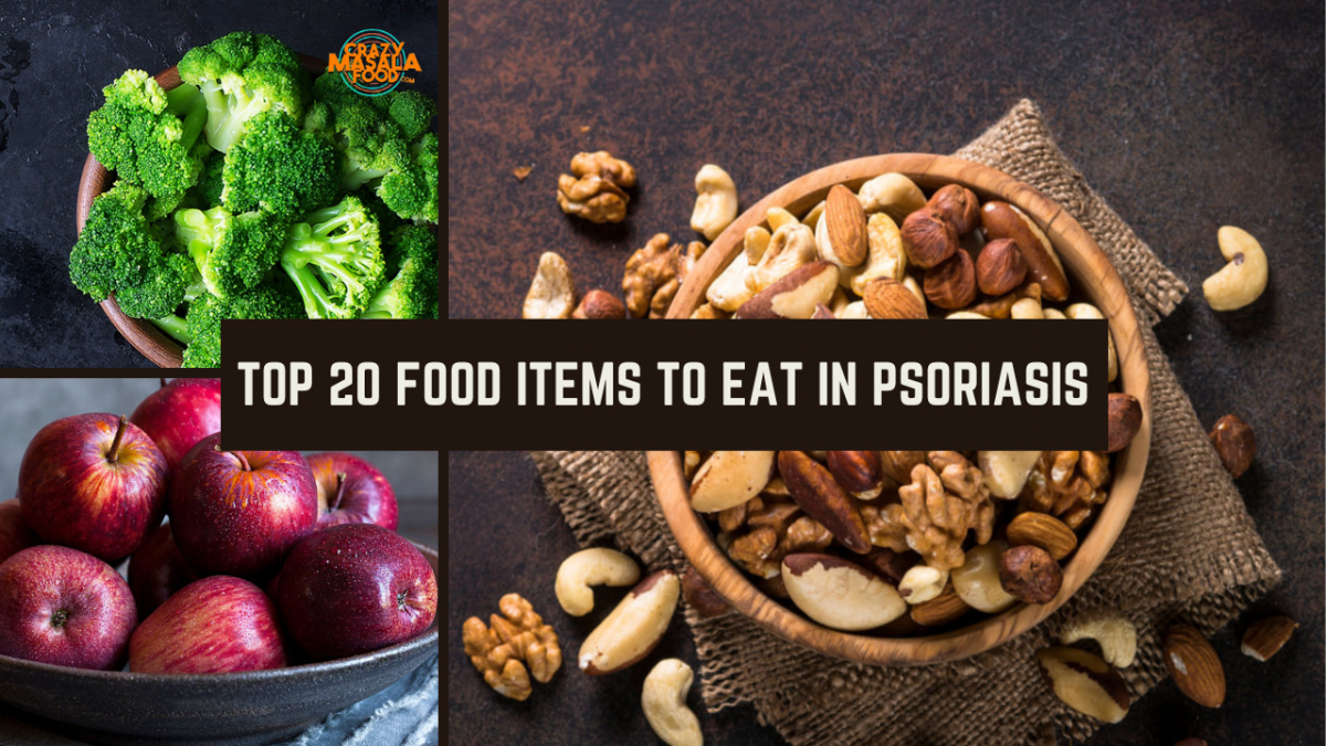 top 20 food items to eat in psoriasis