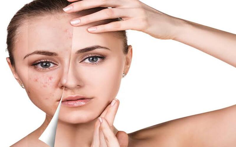 clear-skin