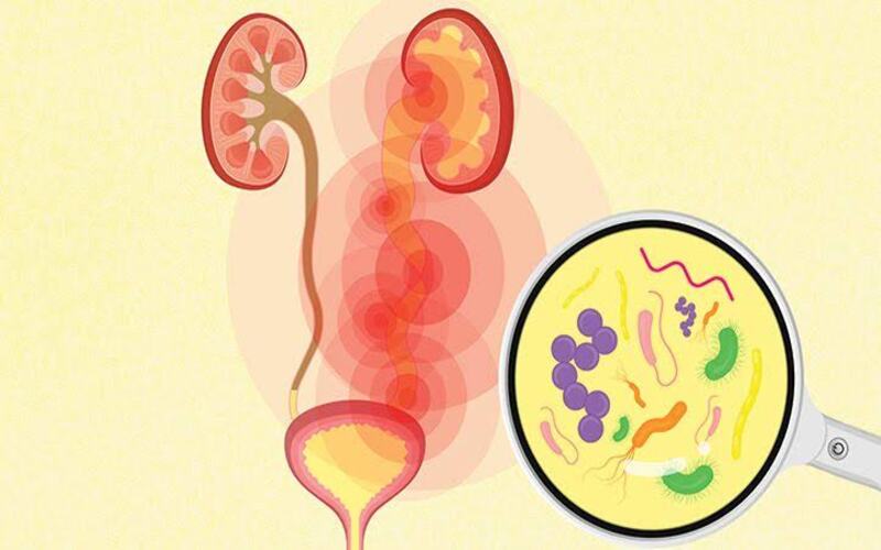 keeps-the-body-away-from-urinary-tract-infections