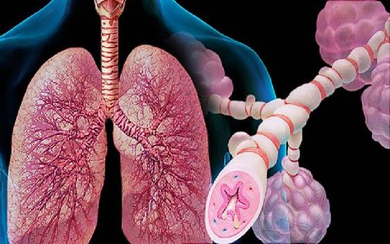 asthma